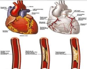 Cardimode